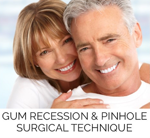 Gum Recession Treatment/Pinhole Surgical Technique